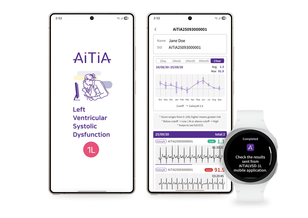 Tecnologías innovadoras de Samsung detectarán afecciones que causan insuficiencia cardíaca