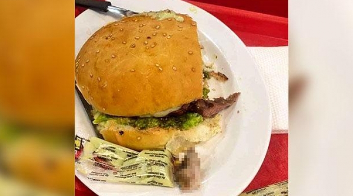 Policía señala que dedo encontrado en una hamburguesa pertenecía a un empleado del local