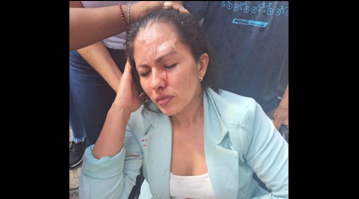 Fiscalía inicia investigación contra 15 personas por violencia contra asambleísta de Santa Cruz