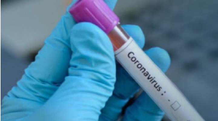 Alerta en Latinoamérica: Confirman primer caso de coronavirus en Argentina y en Chile