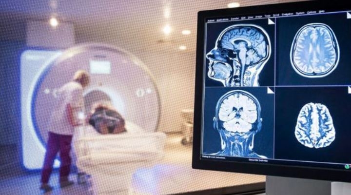 Los médicos advierten de los efectos que el covid-19 puede tener en el cerebro