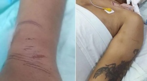 Militar que fue arrestado por la Policía murió el domingo por un hematoma en la cabeza 1