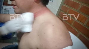 Colegio Médico de Cochabamba denuncia que un galeno fue  apuñalado en una zona de bloqueo 1